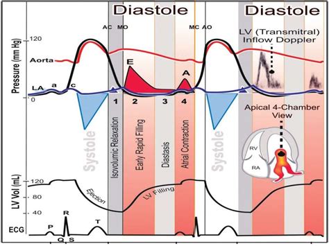 grade 1 lv diastolic dysfunction|life expectancy with diastolic dysfunction.